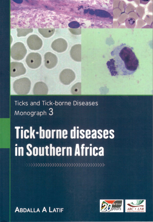 Tick-borne diseases in SA